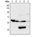 LifeSab™ OCTN2 Rabbit pAb (50 µl)