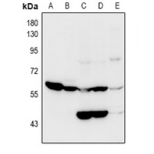 LifeSab™ OCTN2 Rabbit pAb (50 µl)
