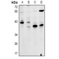 LifeSab™ ZDHHC15 Rabbit pAb (50 µl)