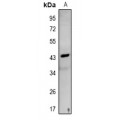 LifeSab™ NDRG3 Rabbit pAb (50 µl)