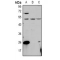 LifeSab™ PPM1L Rabbit pAb (50 µl)