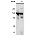 LifeSab™ RANBP17 Rabbit pAb (50 µl)