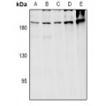 LifeSab™ ARHGEF12 Rabbit pAb (50 µl)