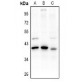 LifeSab™ PDIK1L Rabbit pAb (50 µl)