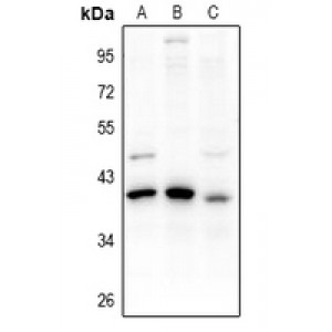 LifeSab™ PDIK1L Rabbit pAb (50 µl)