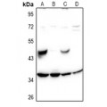 LifeSab™ SH2D5 Rabbit pAb (50 µl)