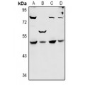 LifeSab™ SYT11 Rabbit pAb (50 µl)
