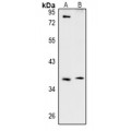 LifeSab™ TSSK4 Rabbit pAb (50 µl)