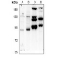 LifeSab™ PTPN22 Rabbit pAb (50 µl)