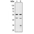 LifeSab™ BRE Rabbit pAb (50 µl)