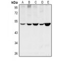 LifeSab™ Cytochrome P450 11B1/2 Rabbit pAb (50 µl)