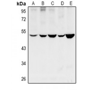 LifeSab™ Cytochrome P450 11B1/2 Rabbit pAb (50 µl)