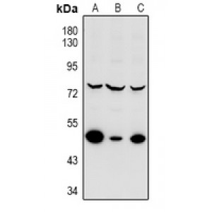 LifeSab™ MNK2 Rabbit pAb (50 µl)