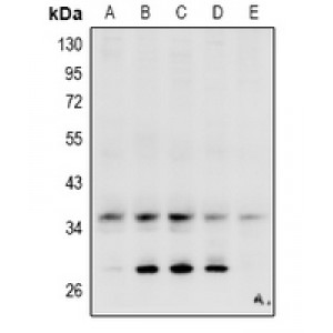 LifeSab™ Carbonic Anhydrase 4 Rabbit pAb (50 µl)