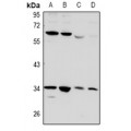 LifeSab™ CD32b Rabbit pAb (50 µl)