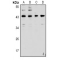 LifeSab™ Cathepsin D Rabbit pAb (50 µl)
