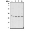 LifeSab™ Cathepsin L HC Rabbit pAb (50 µl)