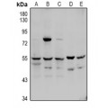 LifeSab™ Factor X LC Rabbit pAb (50 µl)