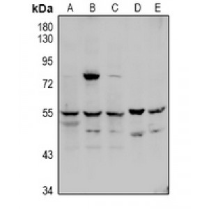 LifeSab™ Factor X LC Rabbit pAb (50 µl)