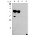 LifeSab™ Ephrin A5 Rabbit pAb (50 µl)