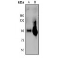 LifeSab™ Plasminogen HC A Rabbit pAb (50 µl)
