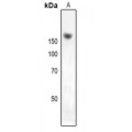 LifeSab™ NKTR Rabbit pAb (50 µl)