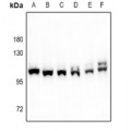 LifeSab™ Factor XIIIa Rabbit pAb (50 µl)