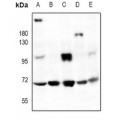 LifeSab™ HMB45 Rabbit pAb (50 µl)