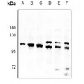 LifeSab™ PAP Rabbit pAb (50 µl)