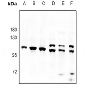 LifeSab™ PAP Rabbit pAb (50 µl)