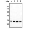 LifeSab™ Mast Cell Tryptase Rabbit pAb (50 µl)
