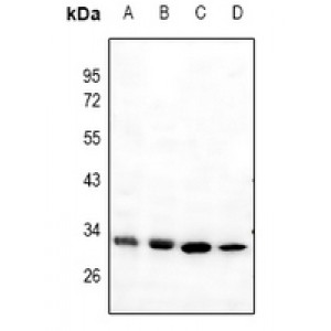 LifeSab™ Mast Cell Tryptase Rabbit pAb (50 µl)