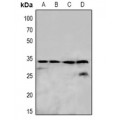 LifeSab™ OUTB1 Rabbit pAb (50 µl)