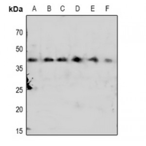 LifeSab™ CDK7 (pT170) Rabbit pAb (50 µl)