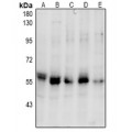 LifeSab™ PINK1 (pS228) Rabbit pAb (50 µl)