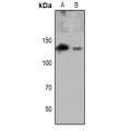 LifeSab™ EPHA8 (pY615) Rabbit pAb (50 µl)