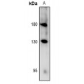 LifeSab™ RET (pY981) Rabbit pAb (50 µl)