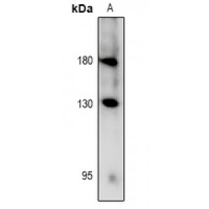 LifeSab™ RET (pY981) Rabbit pAb (50 µl)