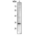 LifeSab™ Cyclin D1 (pT288) Rabbit pAb (50 µl)