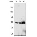 LifeSab™ PTP1B (pY66) Rabbit pAb (50 µl)