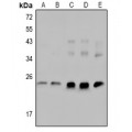 LifeSab™ cTnI (pS23/S24) Rabbit pAb (50 µl)