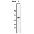 LifeSab™ DAP Kinase 2 Rabbit pAb (50 µl)