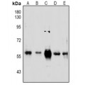 LifeSab™ PINK1 Rabbit pAb (50 µl)