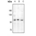 LifeSab™ Androgen Receptor Rabbit pAb (50 µl)