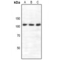 LifeSab™ Semaphorin 4C Rabbit pAb (50 µl)