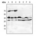 LifeSab™ Oligo2 Rabbit pAb (50 µl)