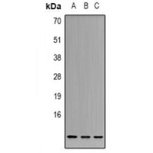 LifeSab™ Cystatin A Rabbit pAb (50 µl)