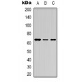 LifeSab™ Estrogen Receptor alpha Rabbit pAb (50 µl)