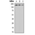 LifeSab™ BRCA1 Rabbit pAb (50 µl)
