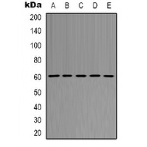 LifeSab™ AKT1 Rabbit pAb (50 µl)